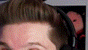 a close up of a man 's forehead with a headset on .